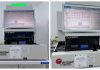 Spitalul din Buhuși a pus în funcțiune un analizor hematologic de ultimă generație pentru diagnostic rapid și precis