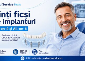 Dinți ficși pe implanturi în Bacău: când pot fi luate în calcul soluțiile All-on-4 și All-on-6